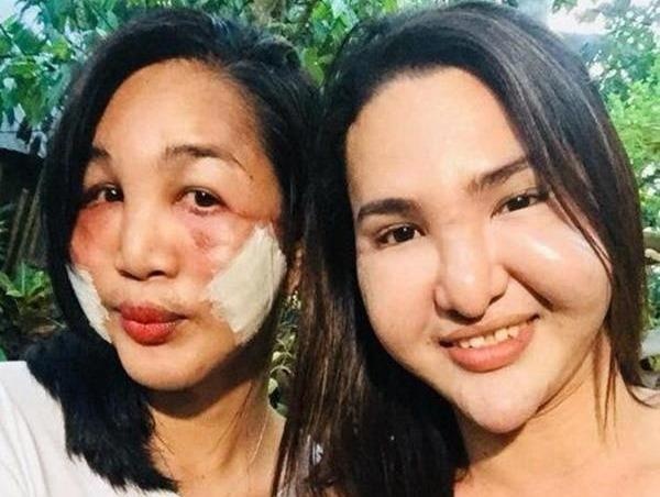 Gioi tre dao keo: Nguoi 'vit hoa thien nga', ke bi goi la ac quy hinh anh