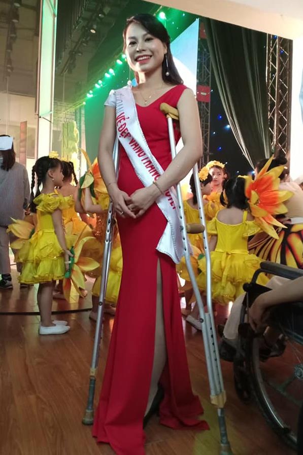 nu sinh mat mot chan anh 5