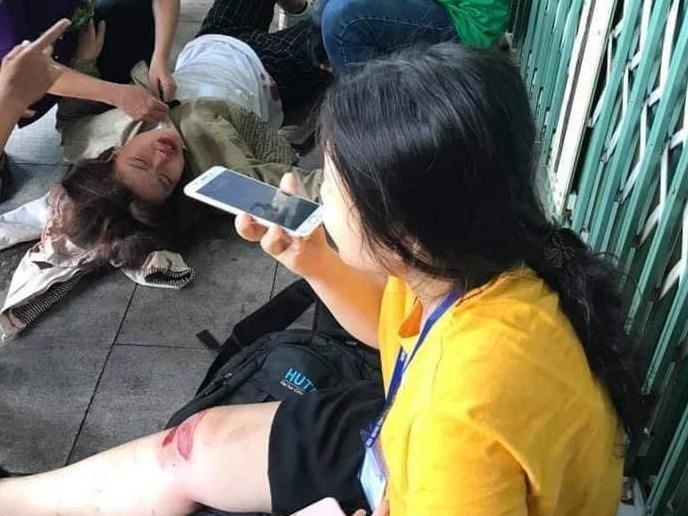 Bi treu gheo tren pho, hai nu sinh nga xe phai nhap vien hinh anh