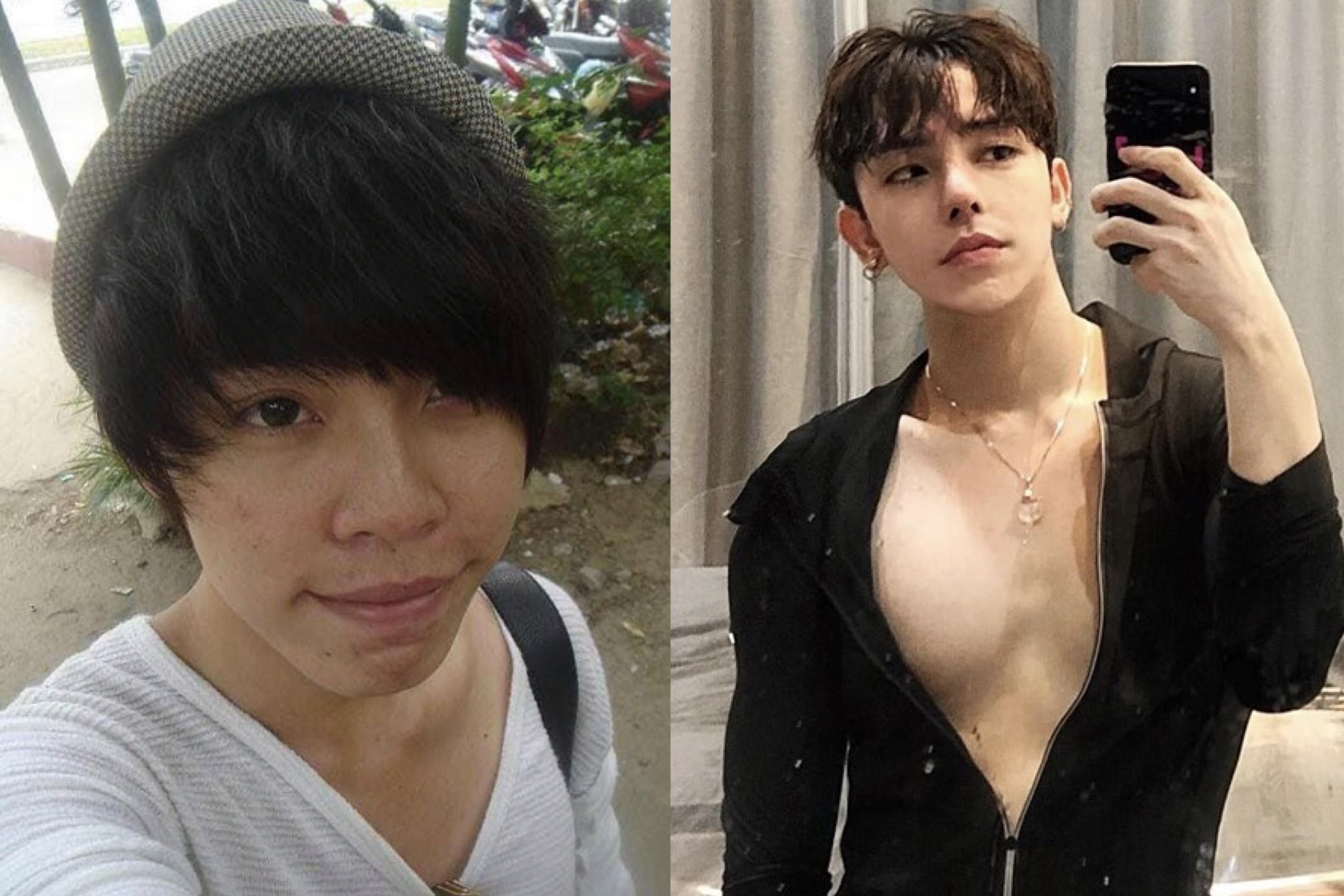 Chang trai Da Nang phau thuat tham my 9 lan trong 10 nam hinh anh