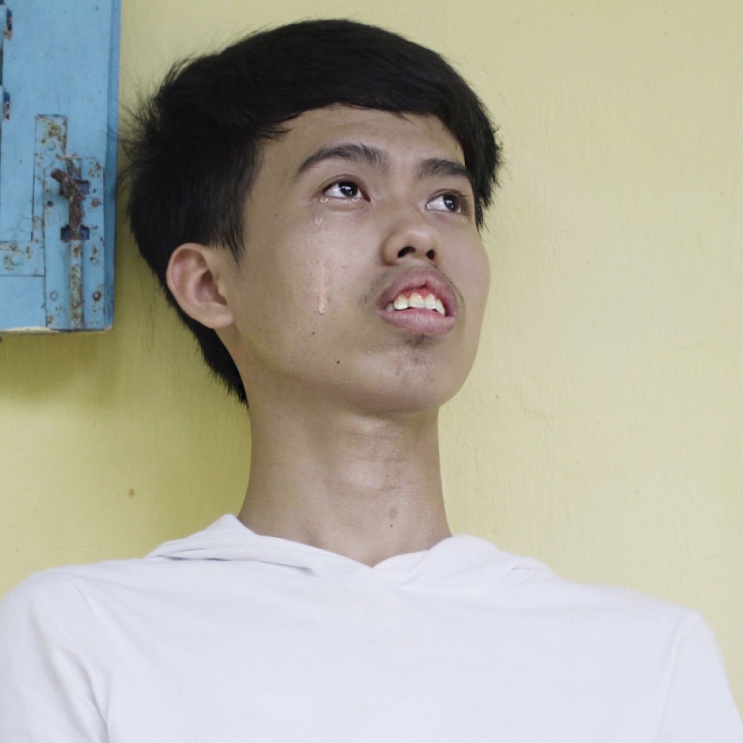 thay doi ngoai hinh nho phau thuat tham my anh 1