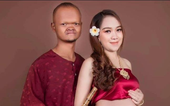 Cap dua lech noi tieng Campuchia sinh con trai dau long hinh anh