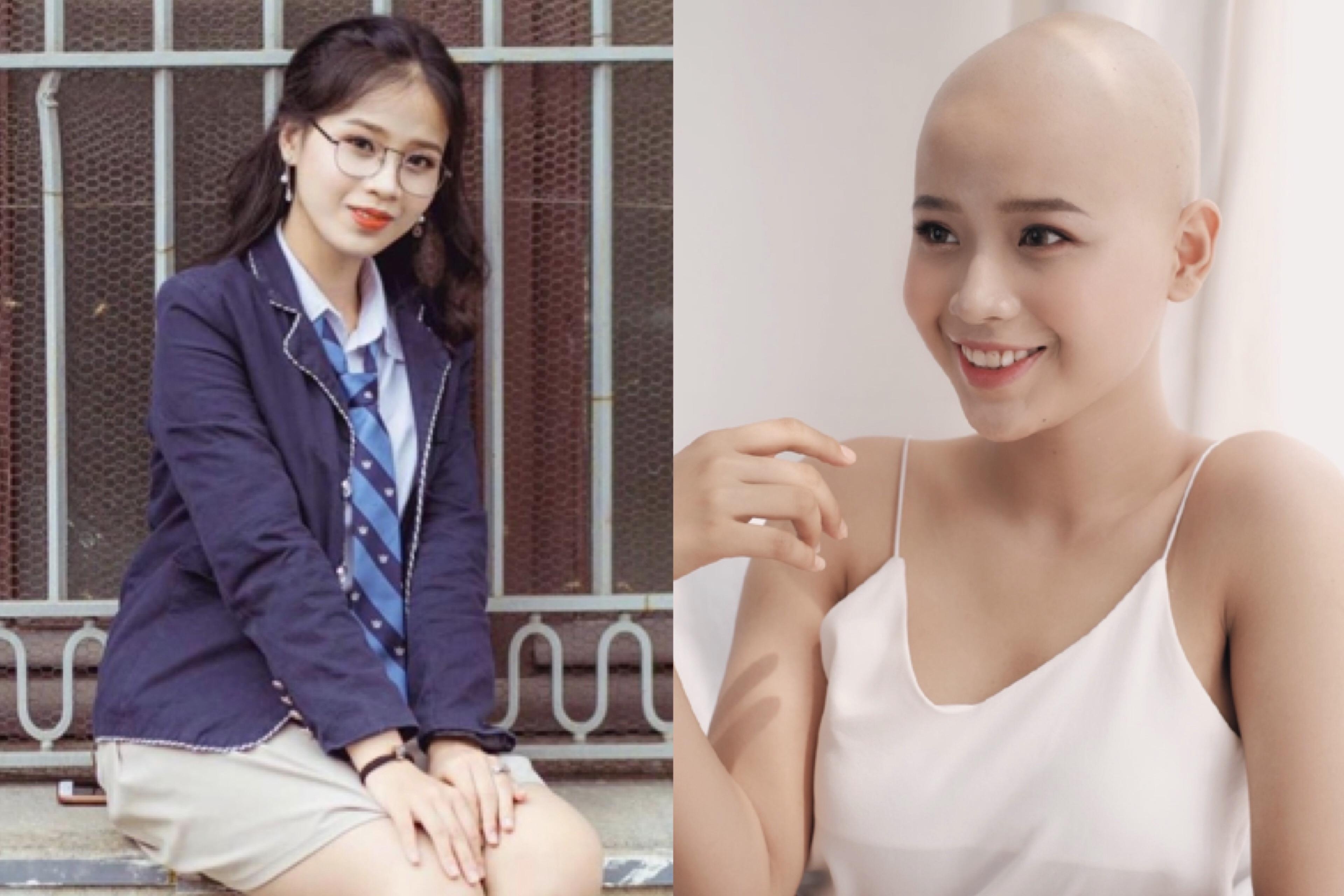 Nu sinh DH Ngoai thuong: ‘Khong nghi ung thu den khi moi 19 tuoi’ hinh anh