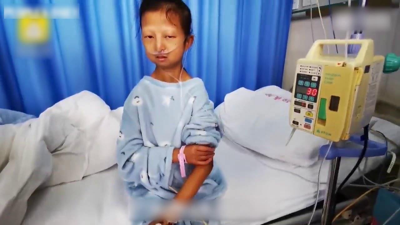 Co gai 24 tuoi chi nang 21,5 kg vi 5 nam nhin an nuoi em trai bi benh hinh anh