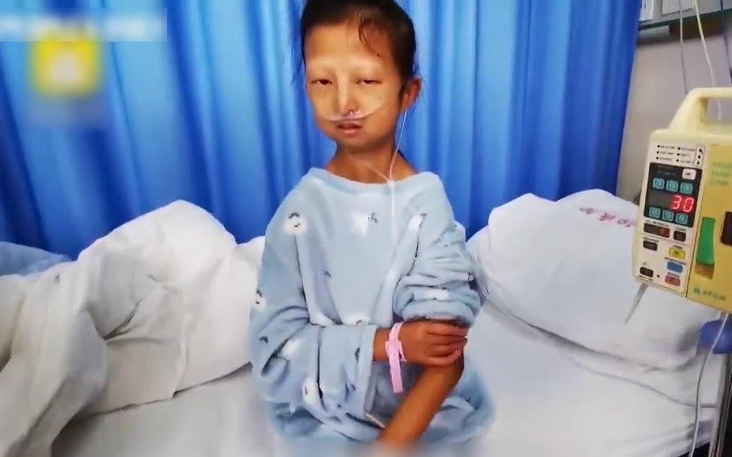 Co gai chi con da boc xuong vi 5 nam nhin an nuoi em bi benh hinh anh