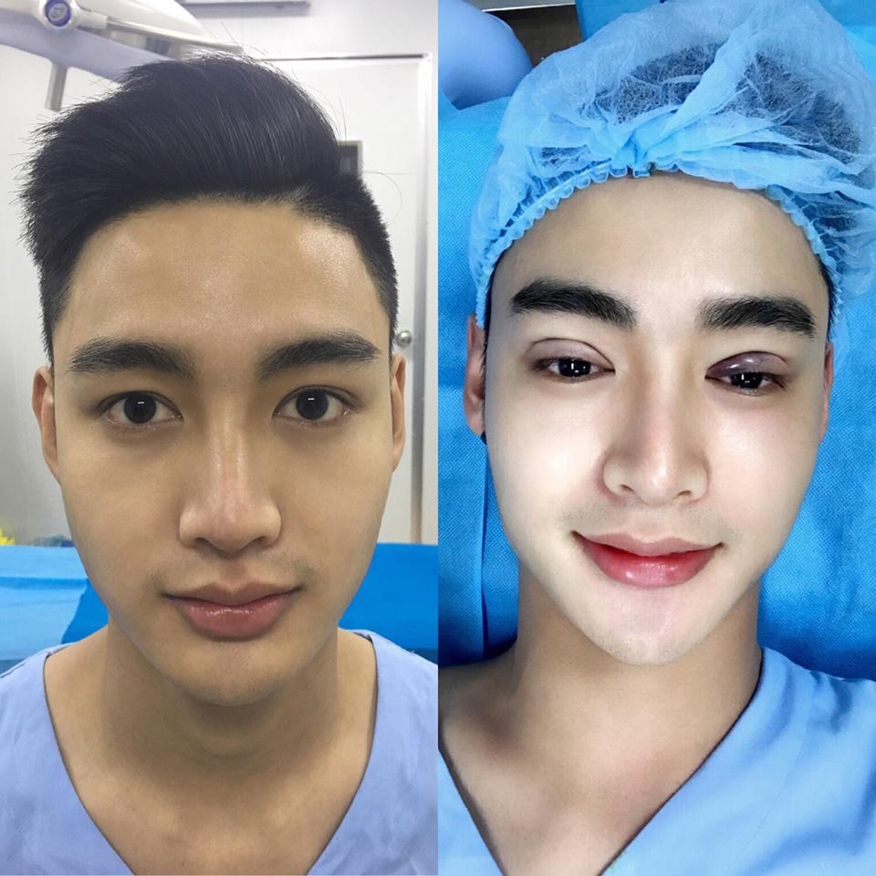 doi doi nho phau thuat tham my anh 8