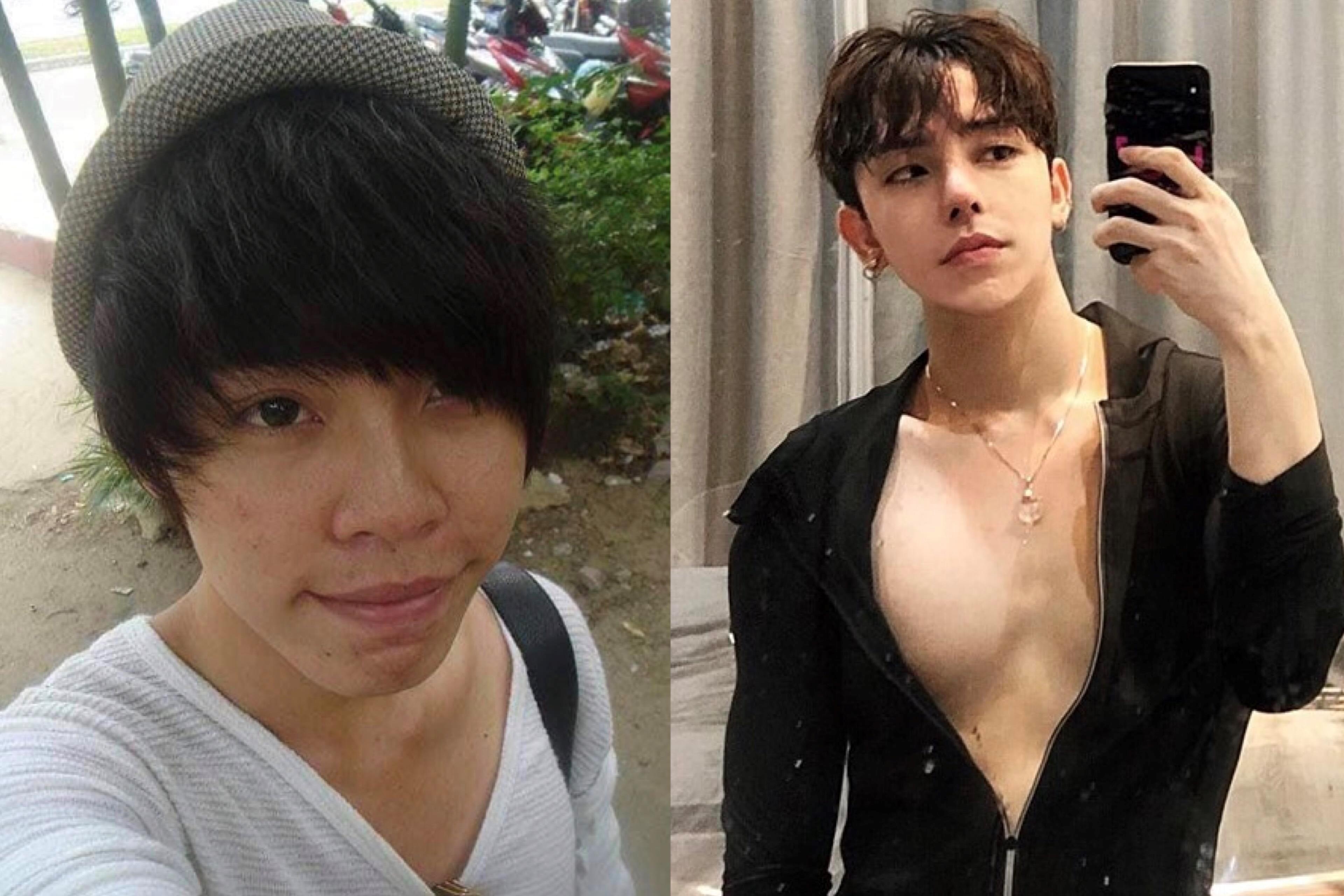 3 chang trai doi doi nho phau thuat tham my hinh anh