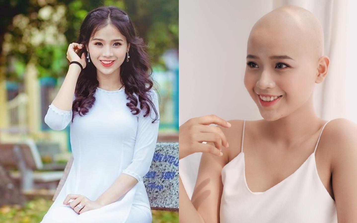 Nu sinh ung thu duoc Benh vien K tai tro chi phi truyen hoa chat hinh anh