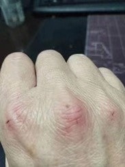 dịch virus corona Vũ Hán ảnh 2 dich virus corona Vu Han anh 2