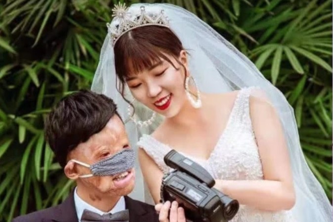 Chuyen tinh cua co gai Trung Quoc va chang trai guong mat bien dang hinh anh