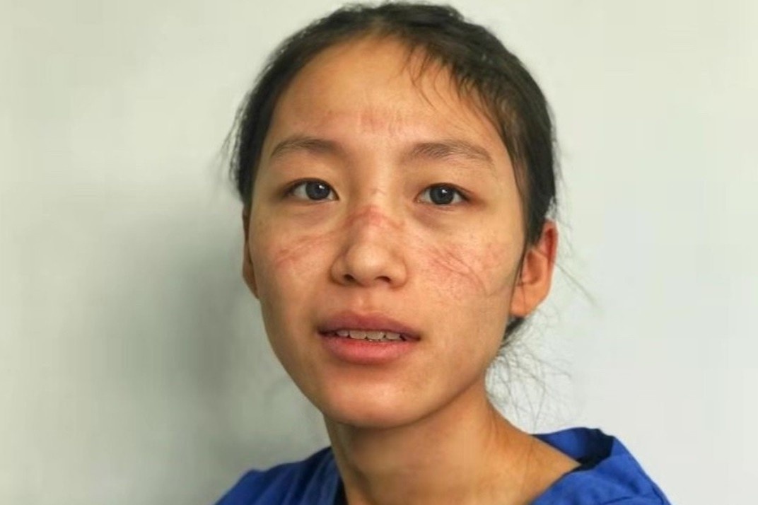 Bac si chong dich corona o Vu Han: 'Dong bim vi di ve sinh la xa xi' hinh anh