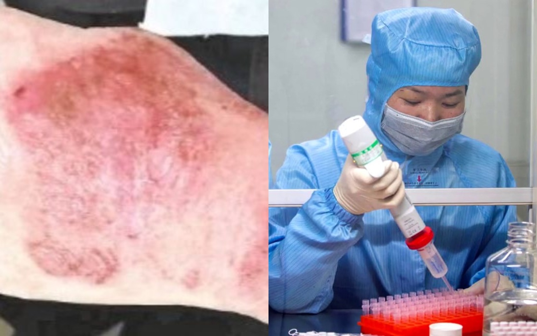 Ban tay sung do cua bac si lam 12 tieng/ngay tai Vu Han hinh anh