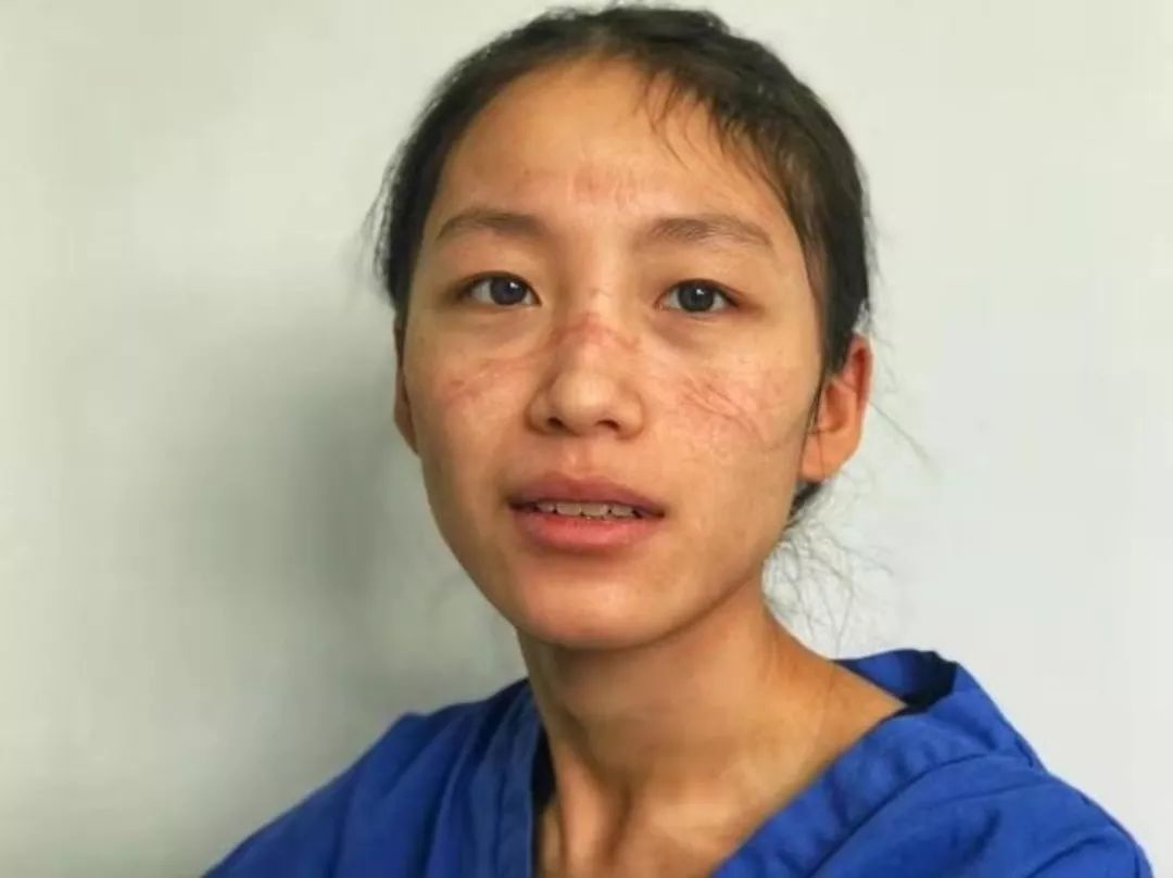 dịch virus corona ảnh 5 dich virus corona anh 5