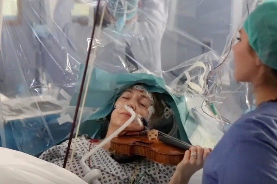 chơi violin trong lúc mổ u não ảnh 1 choi violin trong luc mo u nao anh 1