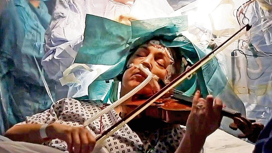 Choi violin trong luc bac si cat bo khoi u nao hinh anh