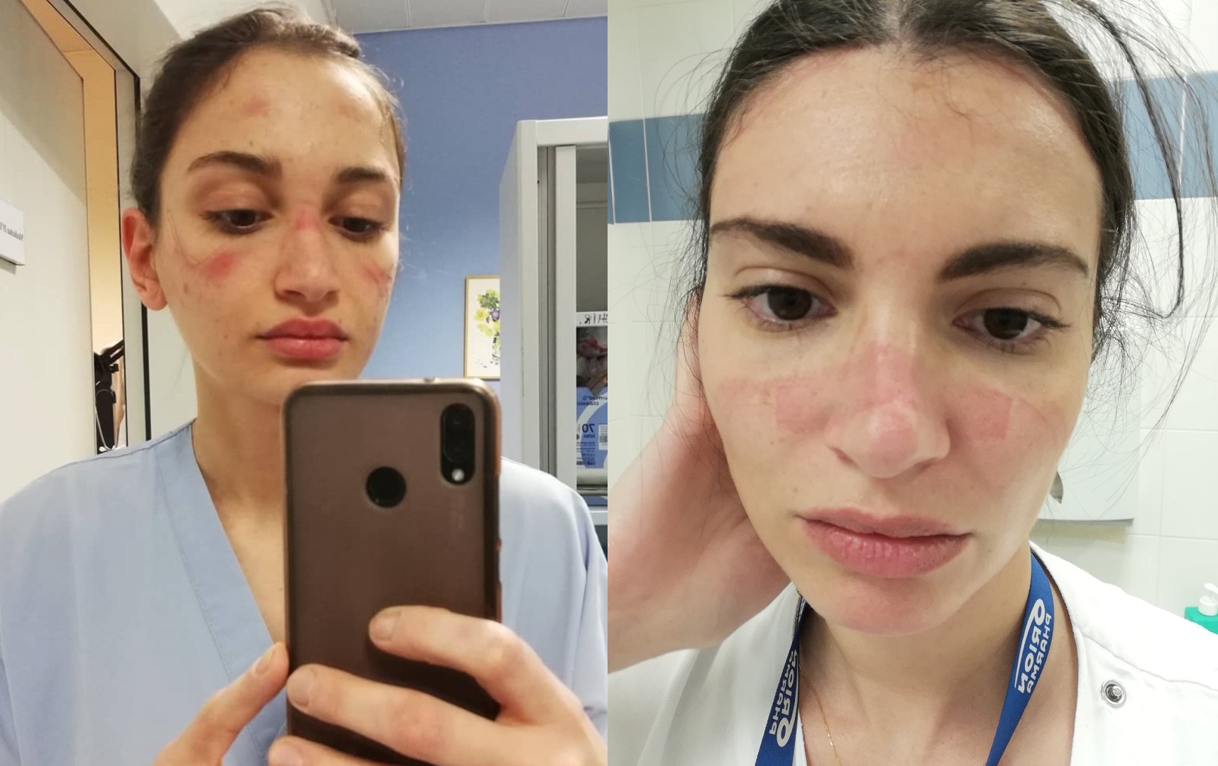 Y ta Italy mat han khau trang, ngu guc vi kiet suc trong khu cach ly hinh anh