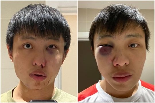 Thiếu niên Anh nhổ nước bọt lên mặt chủ cửa hàng người Trung Quốc ảnh 2 Thieu nien Anh nho nuoc bot len mat chu cua hang nguoi Trung Quoc anh 2