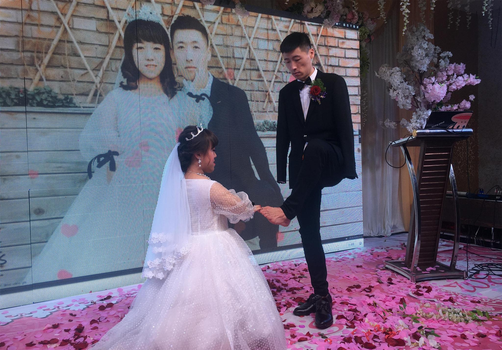 co gai 1, 1 m yeu chang trai khong tay anh 1