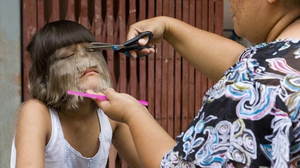 Hinh anh 10 nam truoc cua ‘co be nhieu long nhat the gioi’ hinh anh