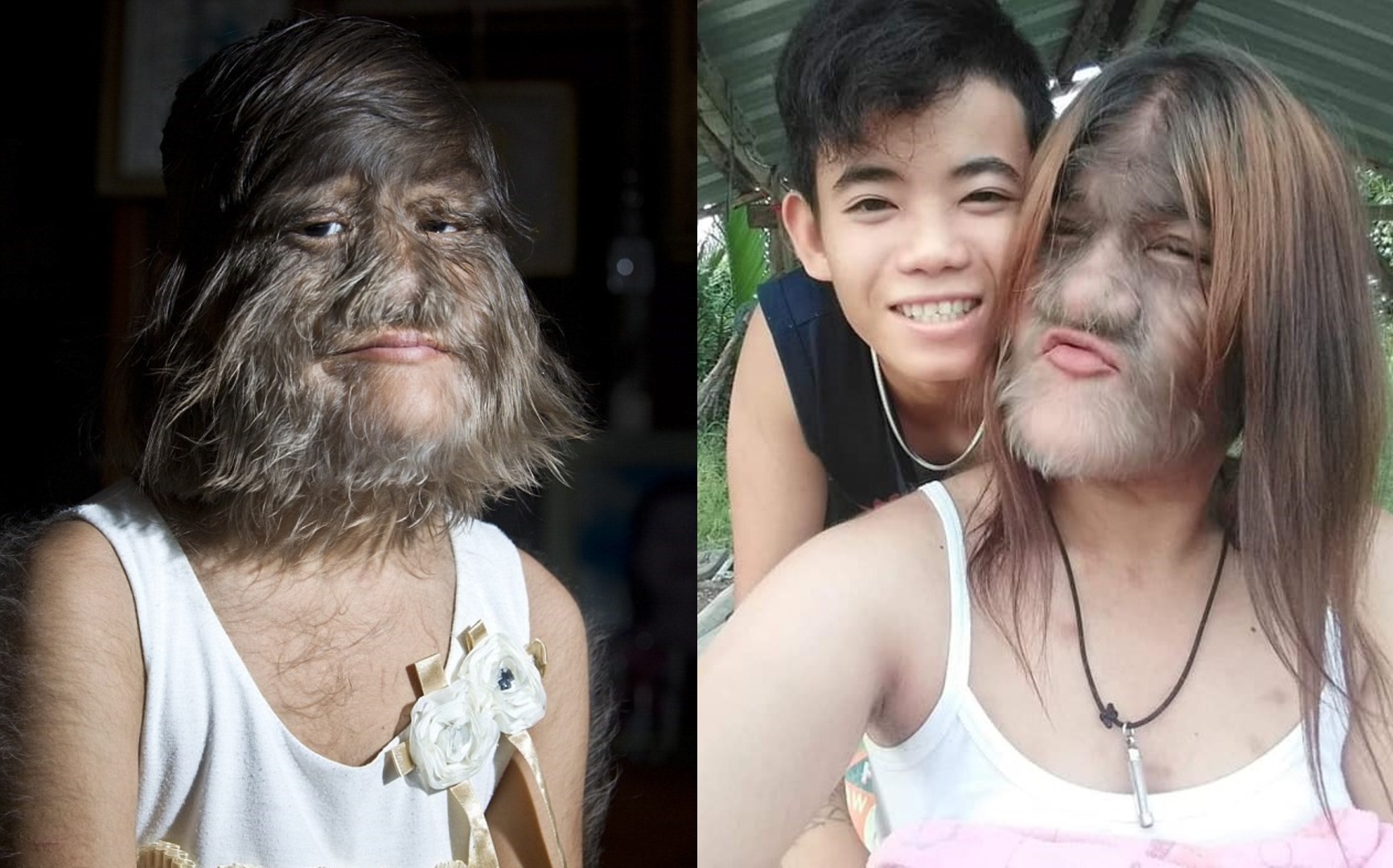 Cuoc song cua ‘Co gai nguoi soi’ tung noi tieng 10 nam truoc hinh anh