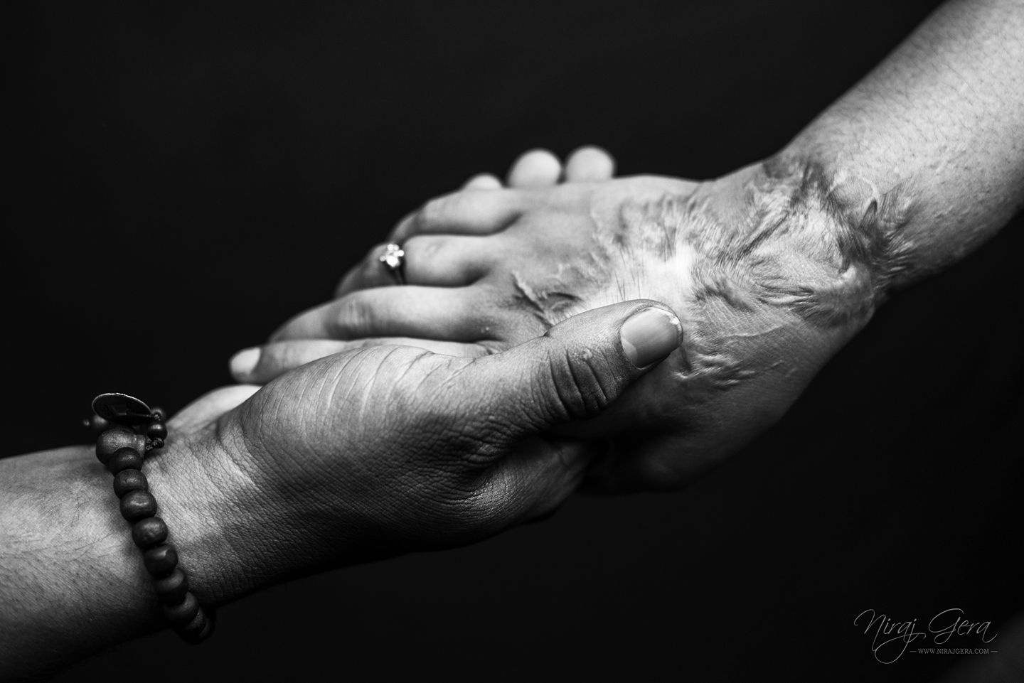 co gai An Do bi tat axit nam 15 tuoi anh 9