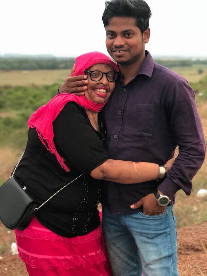 co gai An Do bi tat axit nam 15 tuoi anh 5