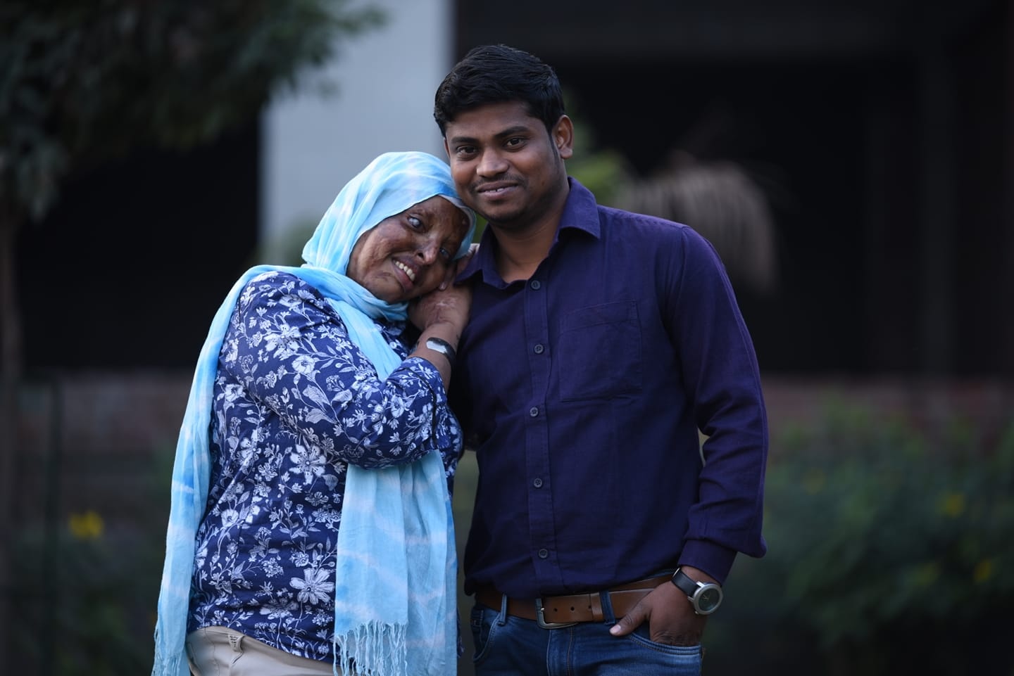 co gai An Do bi tat axit nam 15 tuoi anh 7