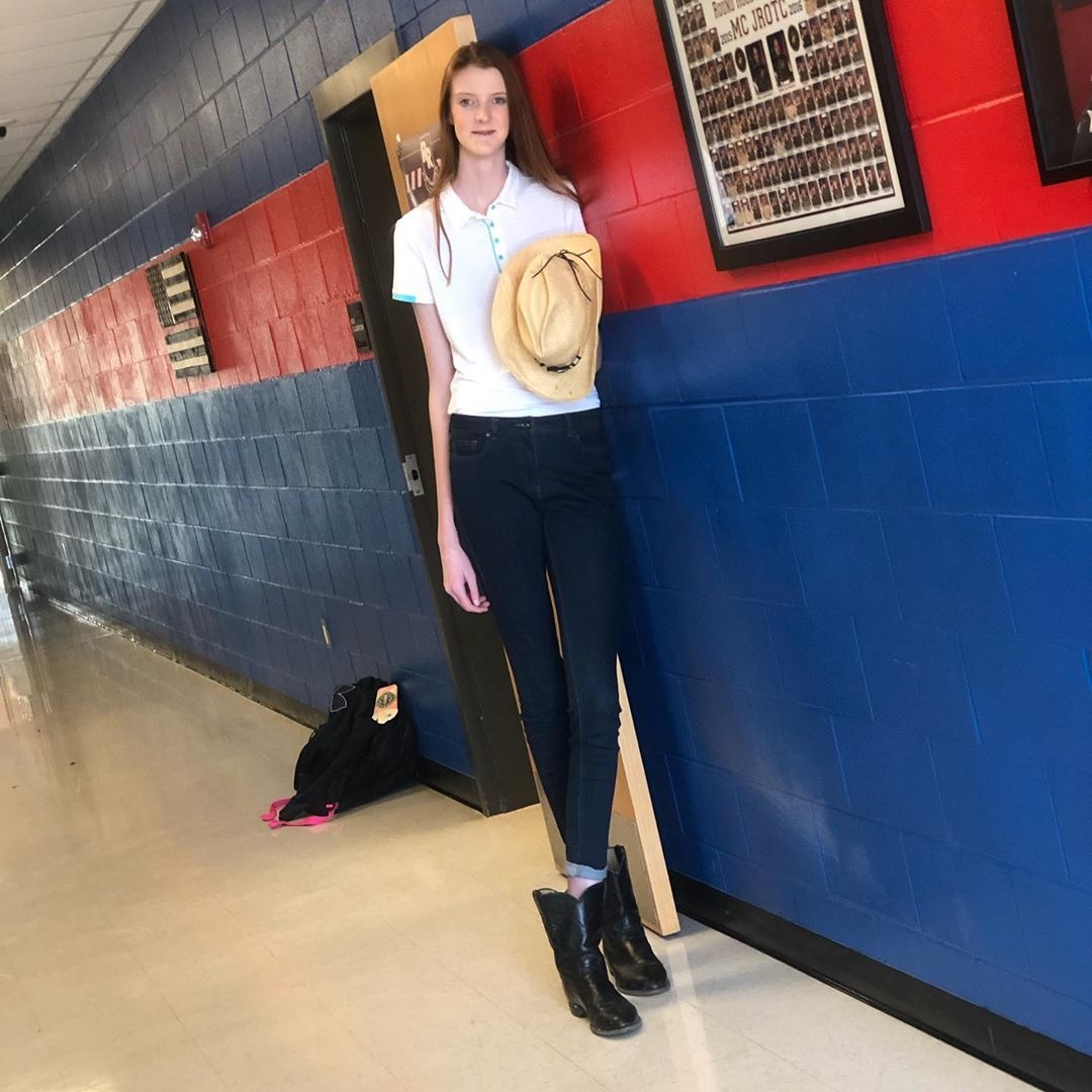 co gai 16 tuoi co doi chan dai nhat the gioi anh 5