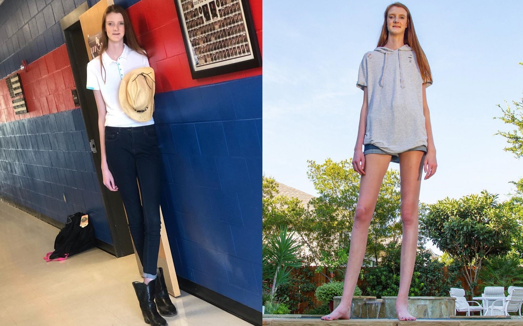 Co gai 16 tuoi cao 2,1 m, so huu doi chan dai nhat the gioi hinh anh