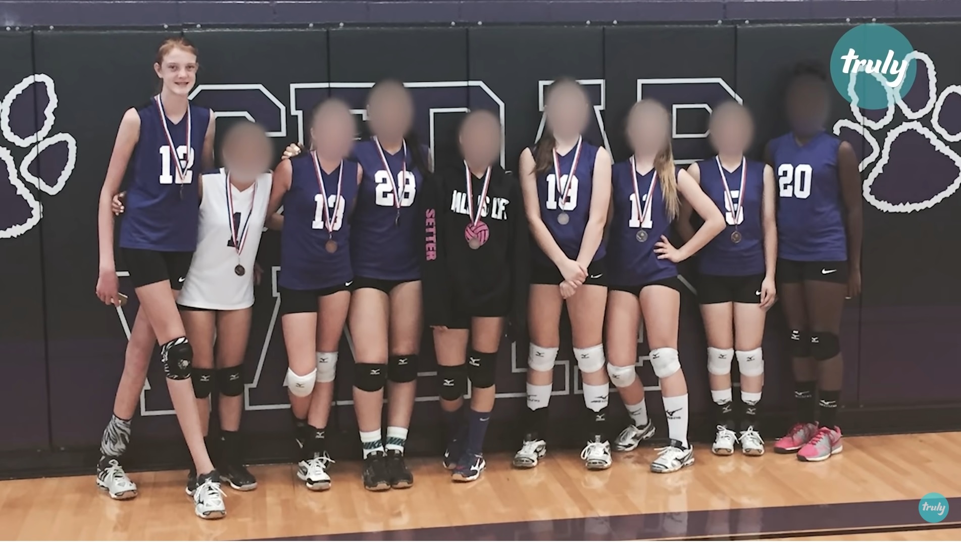 co gai 16 tuoi co doi chan dai nhat the gioi anh 7