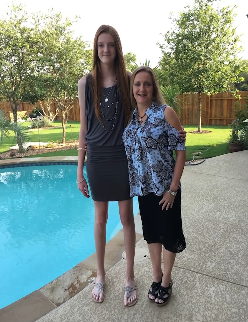 cô gái 16 tuổi có đôi chân dài nhất thế giới ảnh 3 co gai 16 tuoi co doi chan dai nhat the gioi anh 3