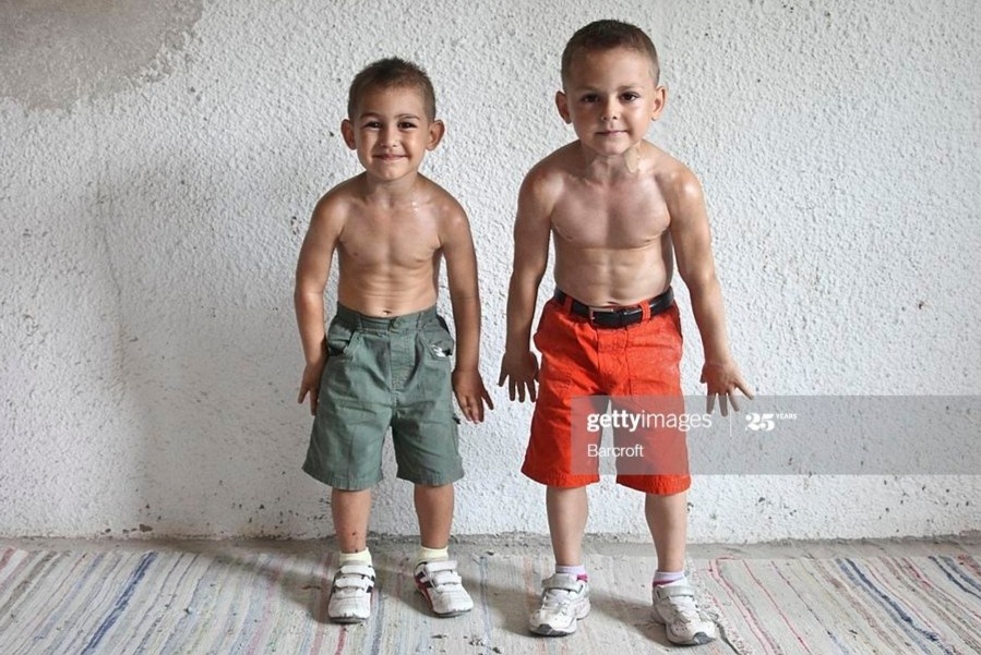 'Hai anh em khoe nhat the gioi' thuc hien nhieu dong tac mao hiem hinh anh