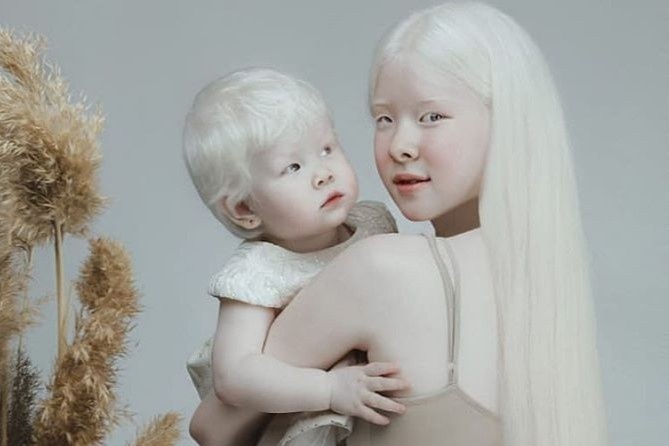 2 chi em bach tang o Kazakhstan noi tieng nho ve dep khac la hinh anh