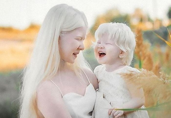 Ve dep 'don tim' dan mang cua 2 chi em bach tang o Kazakhstan hinh anh