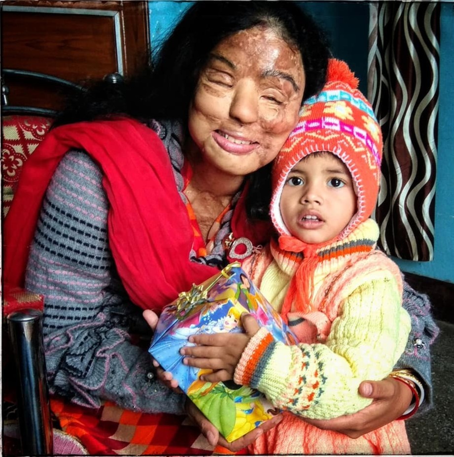 co gai bi tan cong axit thang Ai la trieu phu anh 10