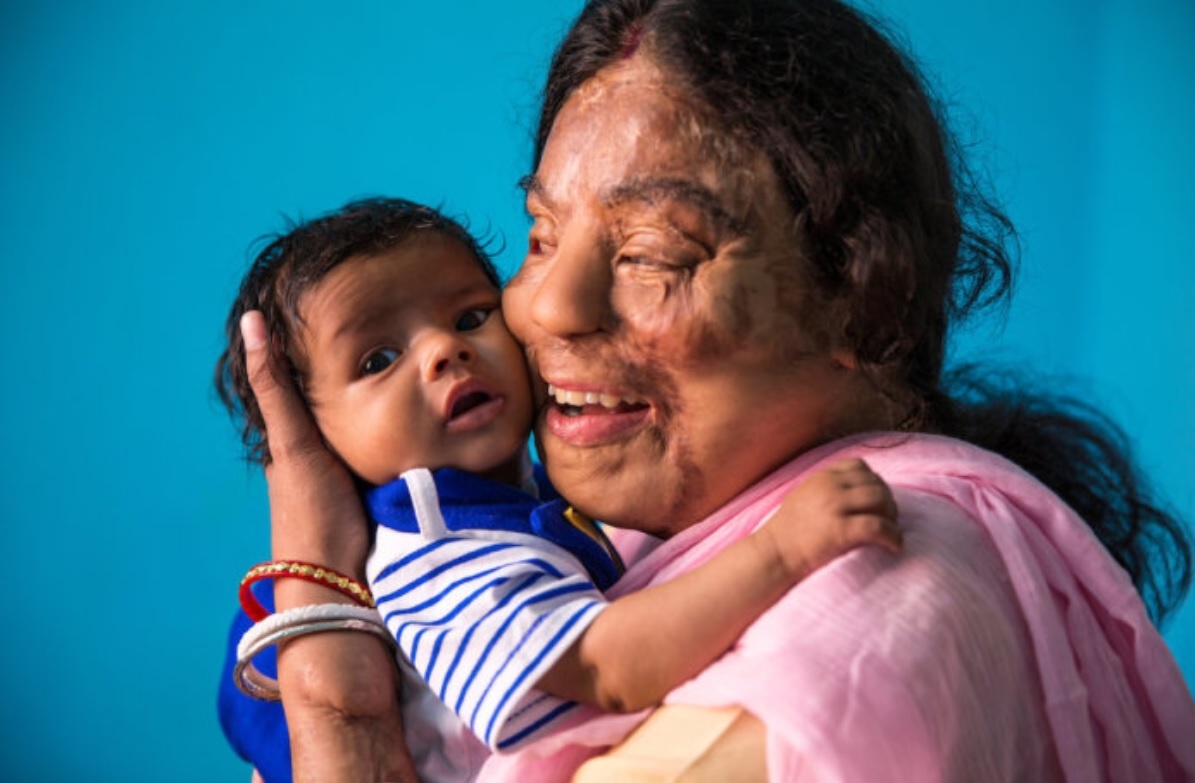 co gai bi tan cong axit thang Ai la trieu phu anh 8