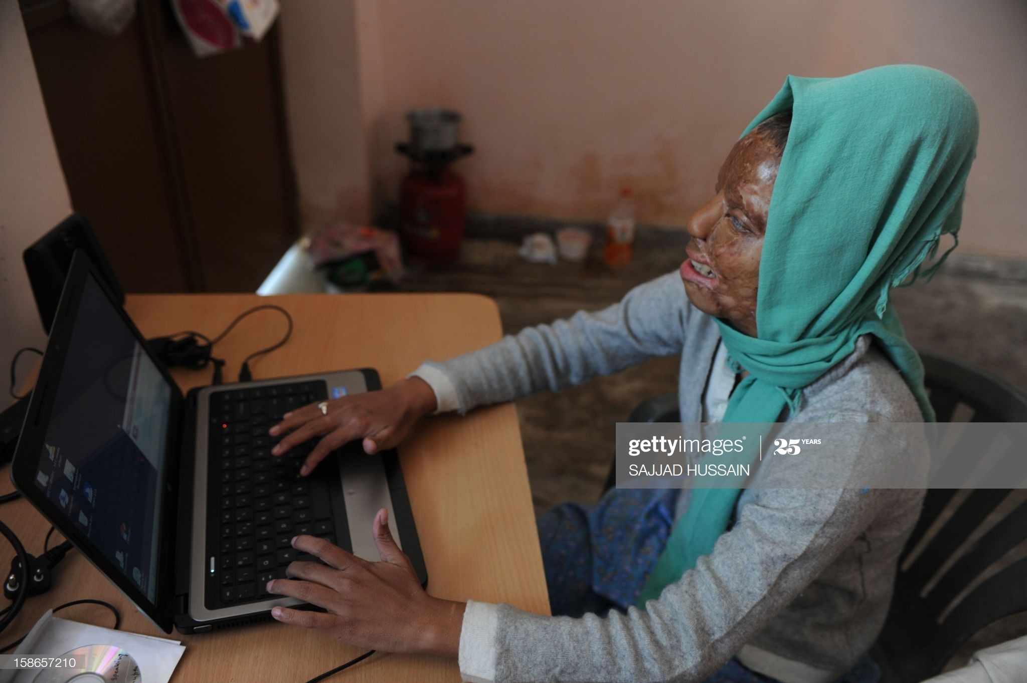 co gai bi tan cong axit thang Ai la trieu phu anh 6