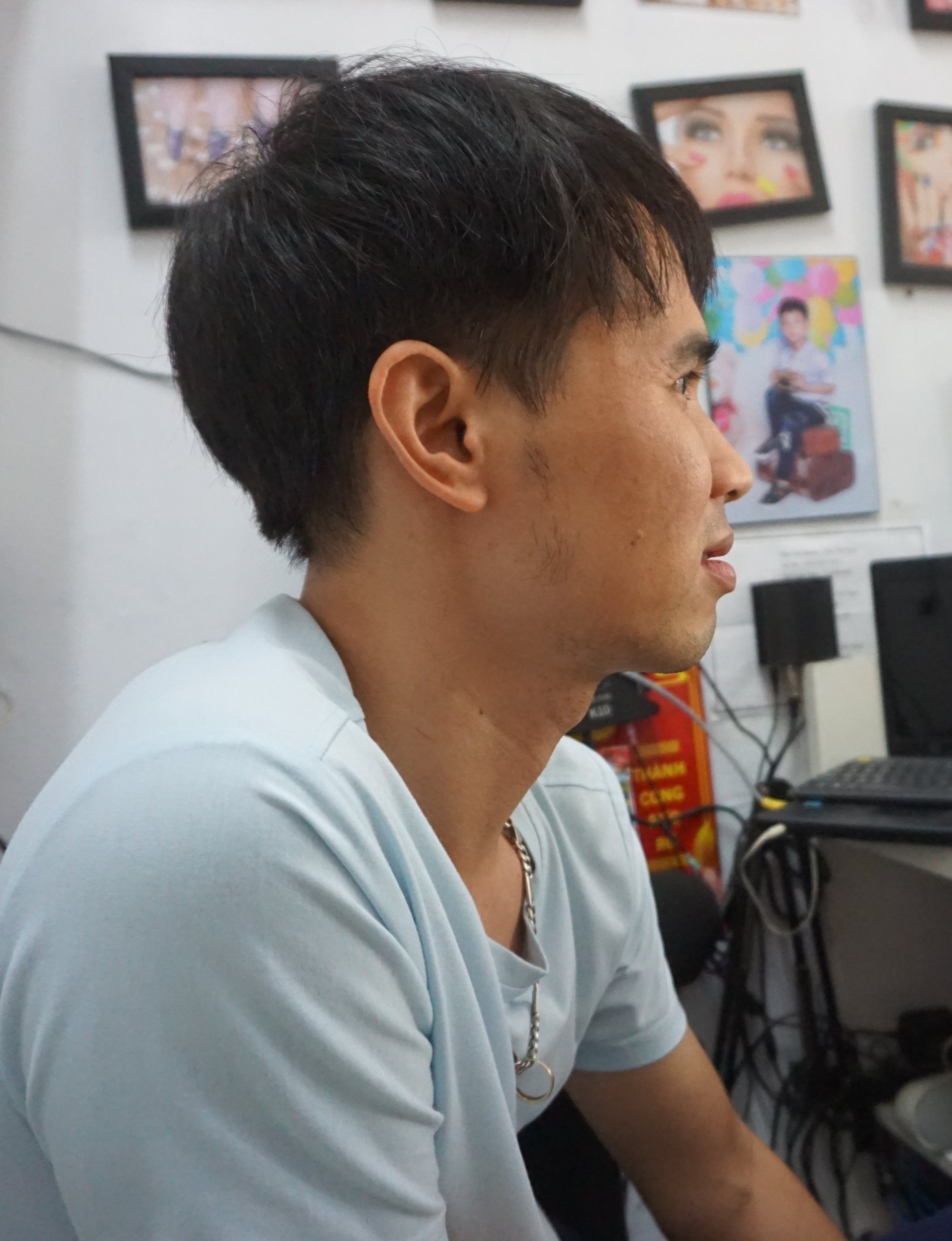 anh chang cut 2 chan lay vo nho mang xa hoi anh 3