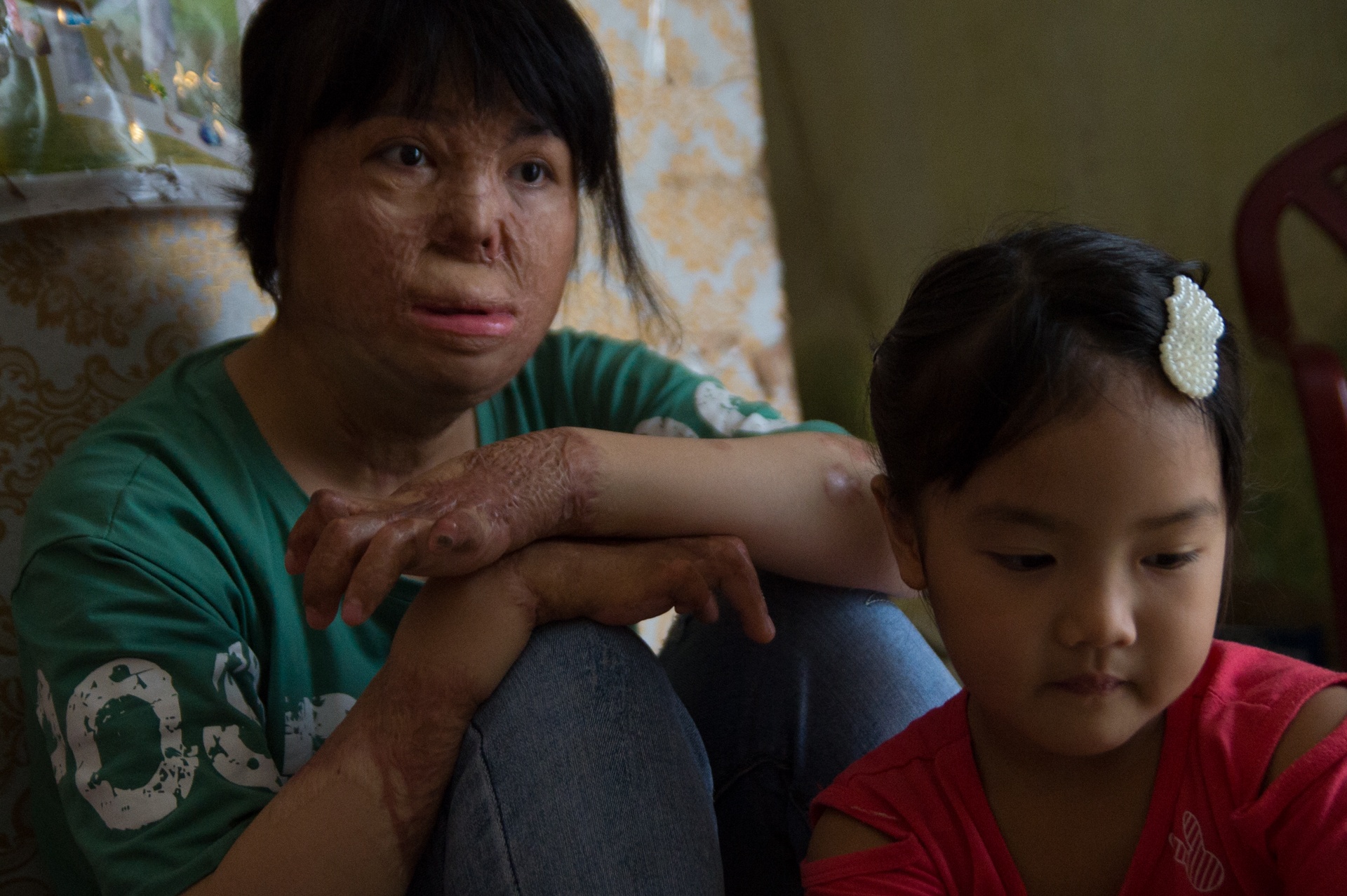 co gai bi chong tam xang dot anh 1