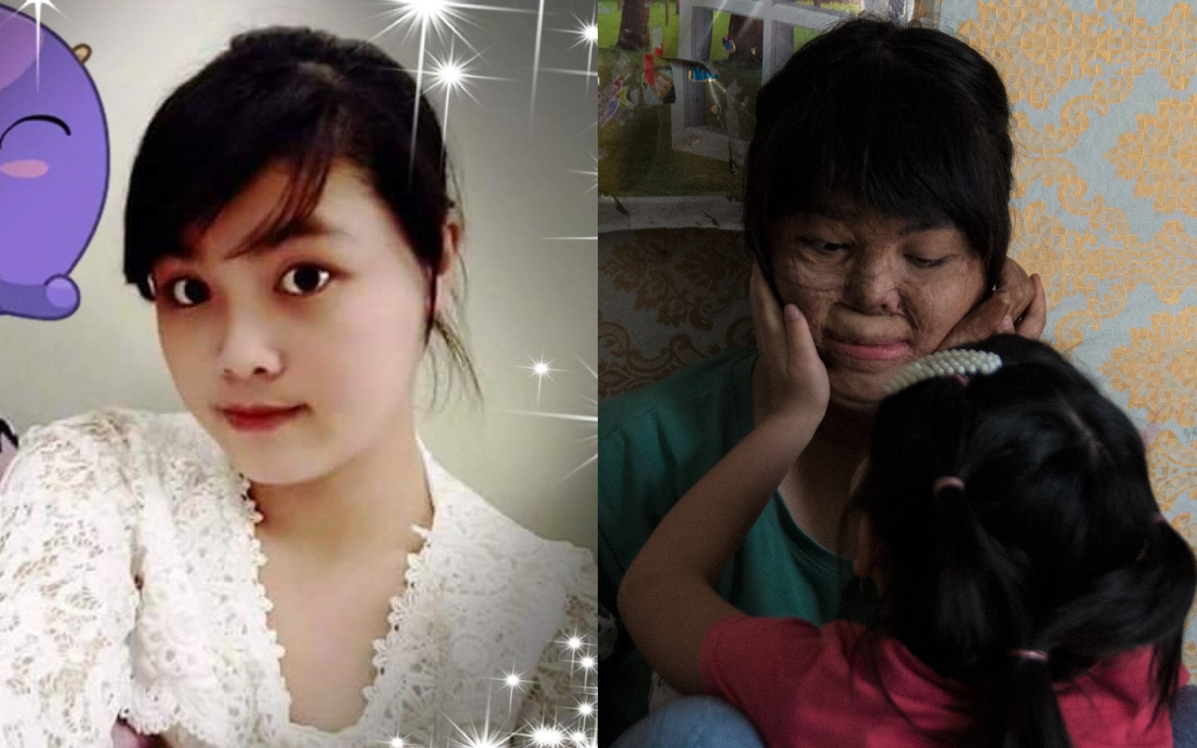 4 nam tim lai binh yen cua co gai bi chong tuoi xang thieu song hinh anh