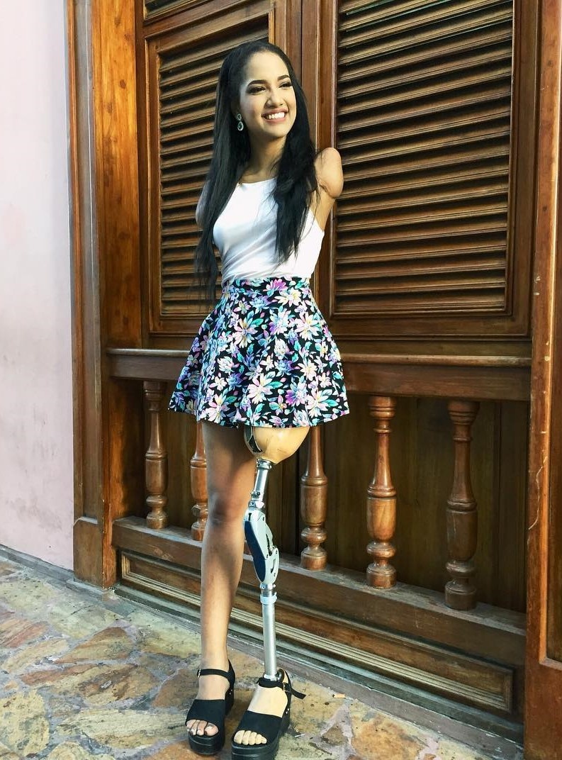 cô gái cụt 3 chi truyền cảm hứng ảnh 7 co gai cut 3 chi truyen cam hung anh 7