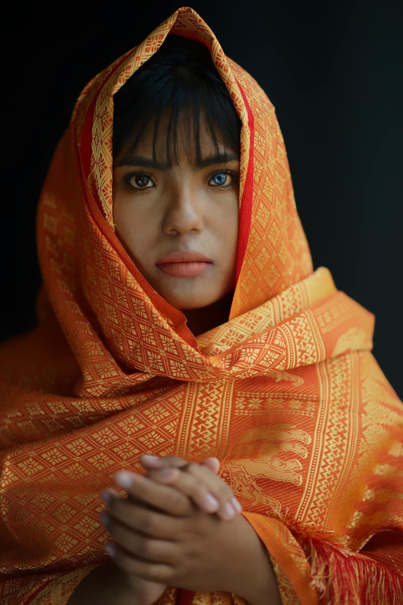 co gai Cham co 2 mau mat anh 2