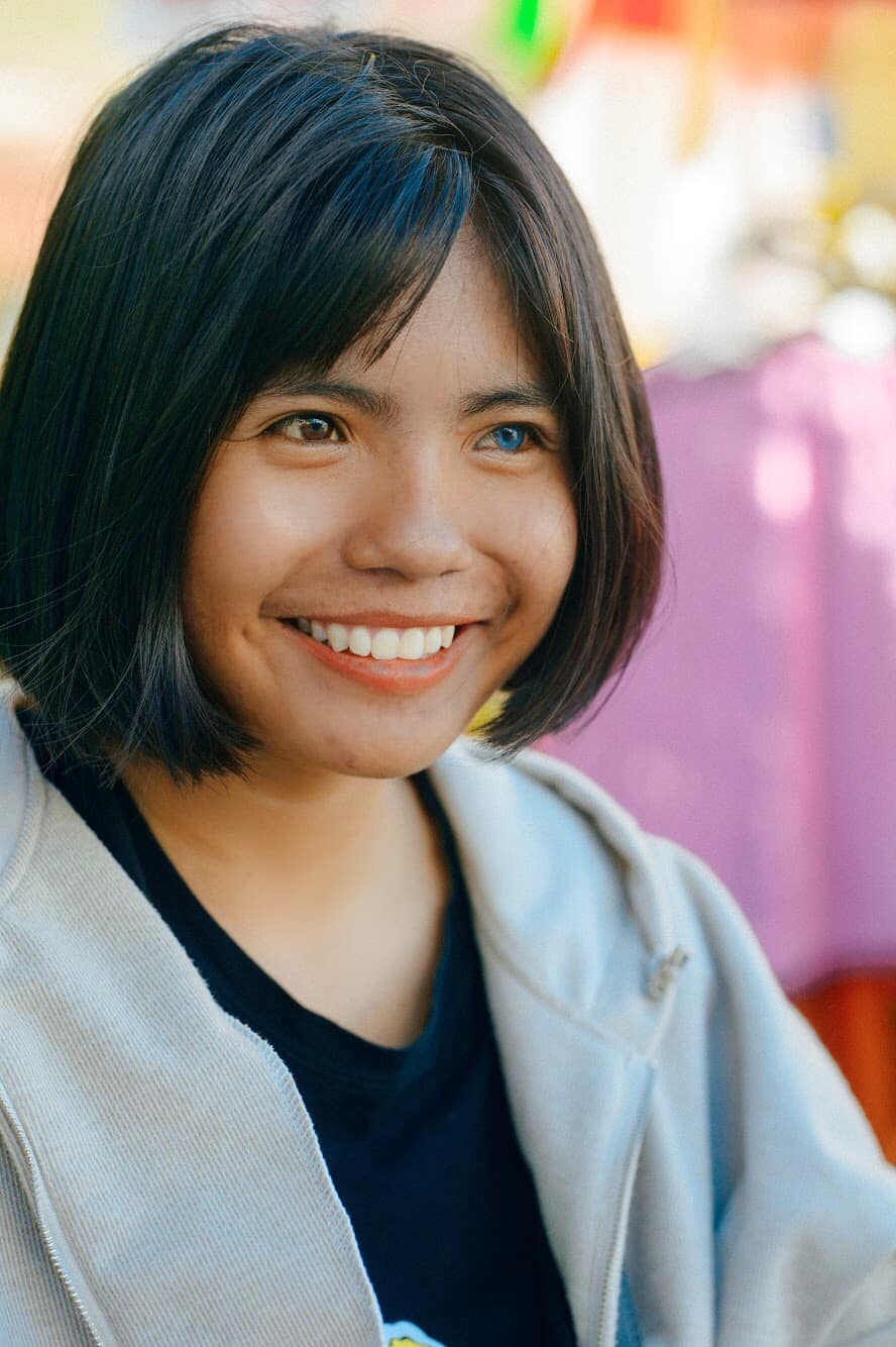 co gai Cham co 2 mau mat anh 4