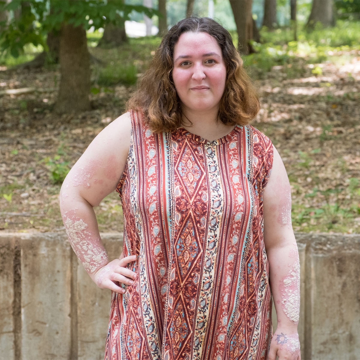 Co gai bi vay nen che kin 90% co the anh 1