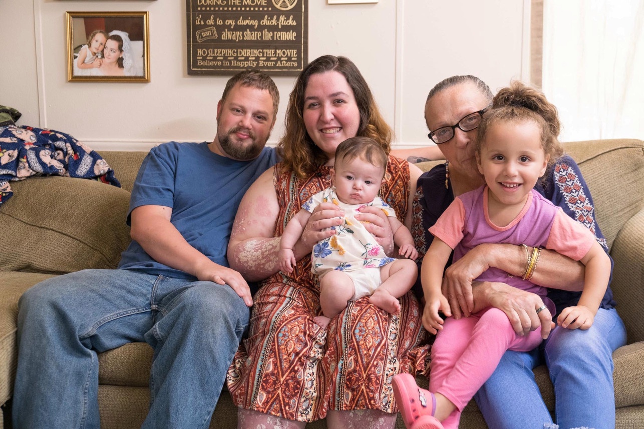 Co gai bi vay nen che kin 90% co the anh 2