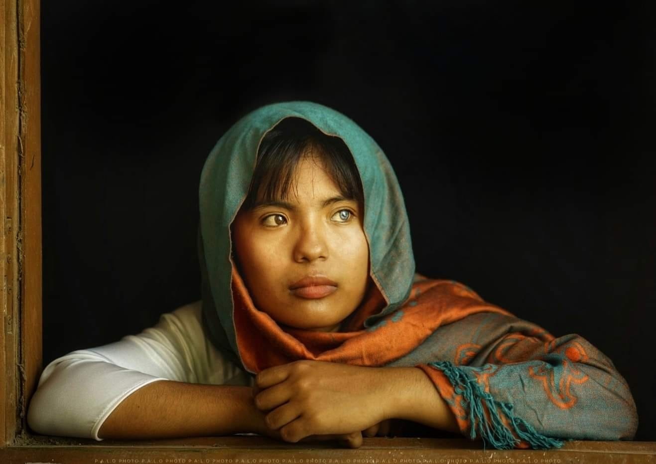 co gai Cham co 2 mau mat anh 7