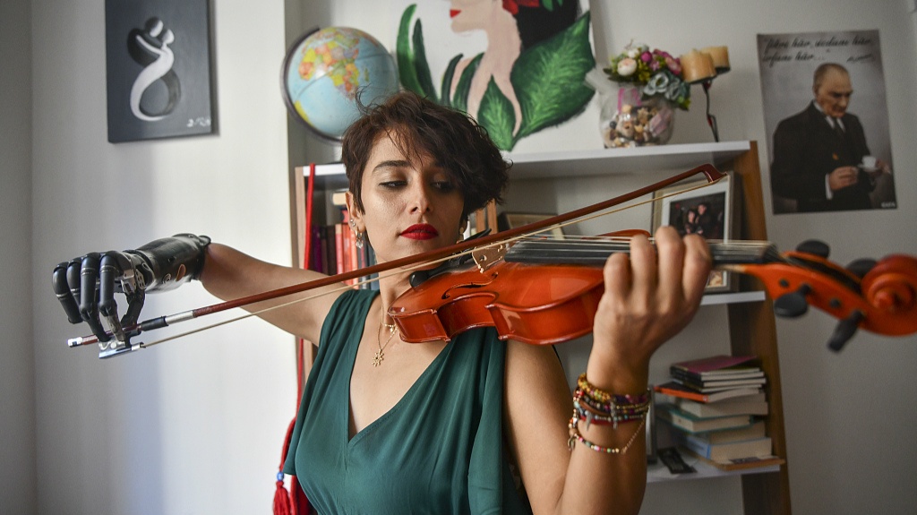 co gai voi canh tay bionic anh 4