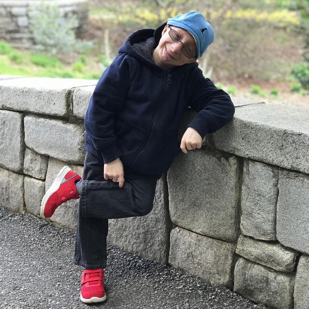 chang nguoi lun 28 tuoi chi cao 86 cm anh 1