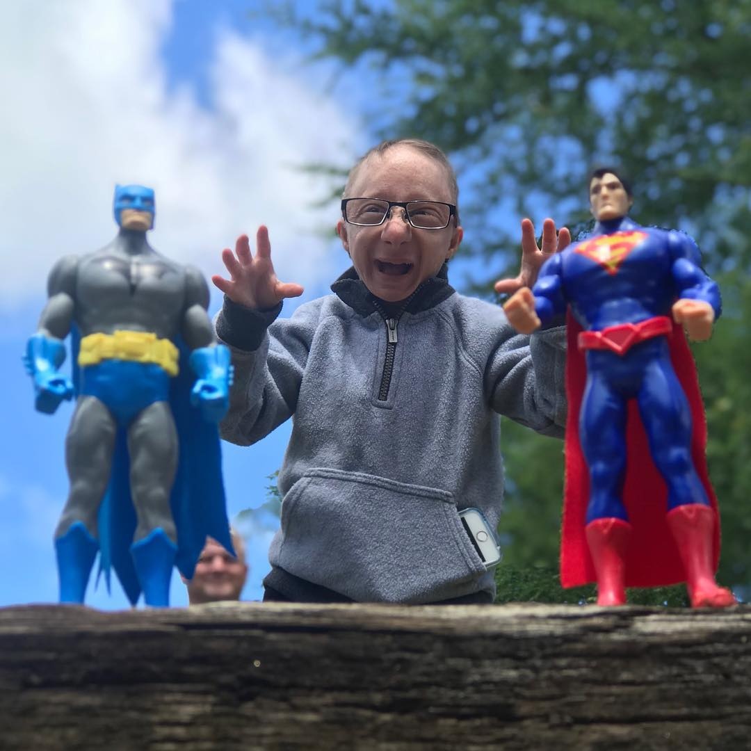 chang nguoi lun 28 tuoi chi cao 86 cm anh 3