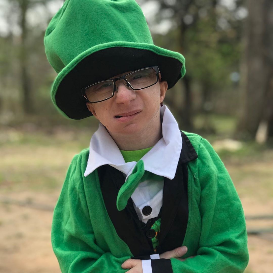 chang nguoi lun 28 tuoi chi cao 86 cm anh 7